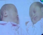 羅馬尼亞：雙胞胎女嬰出生日期相隔2月