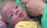 波蘭：奇跡！人工腎臟救活1.8磅早產兒